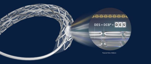 Abluminus DES+ — изображение 2