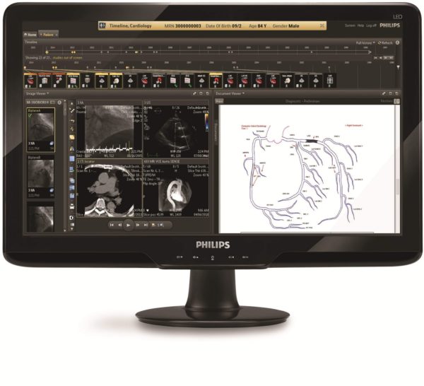 IntelliSpace Cardiovascular