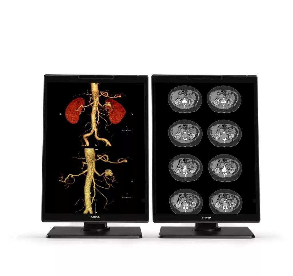 Nio Color 3MP (MDNC-3521)